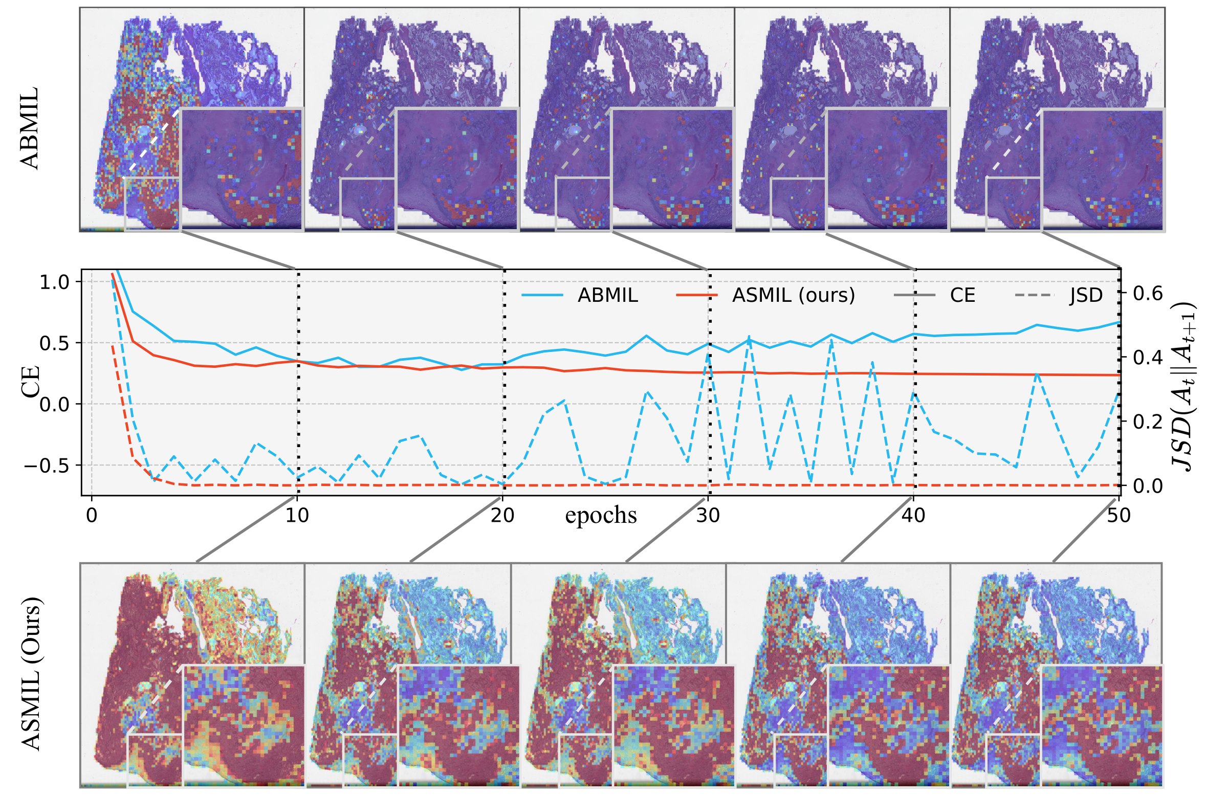 ABMIL fluctuation results